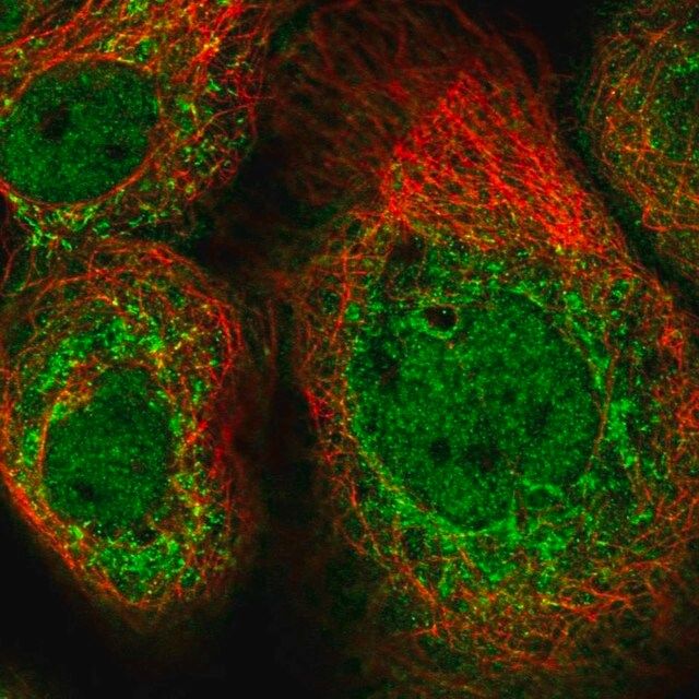 Anti-CLUAP1 antibody produced in rabbit