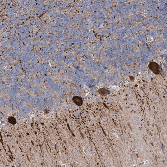 Anti-CMBL antibody produced in rabbit