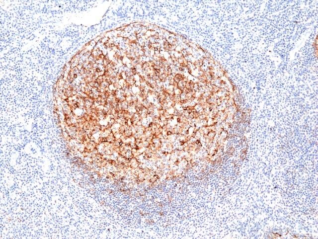 Anti-Clusterin Rabbit Monoclonal Antibody