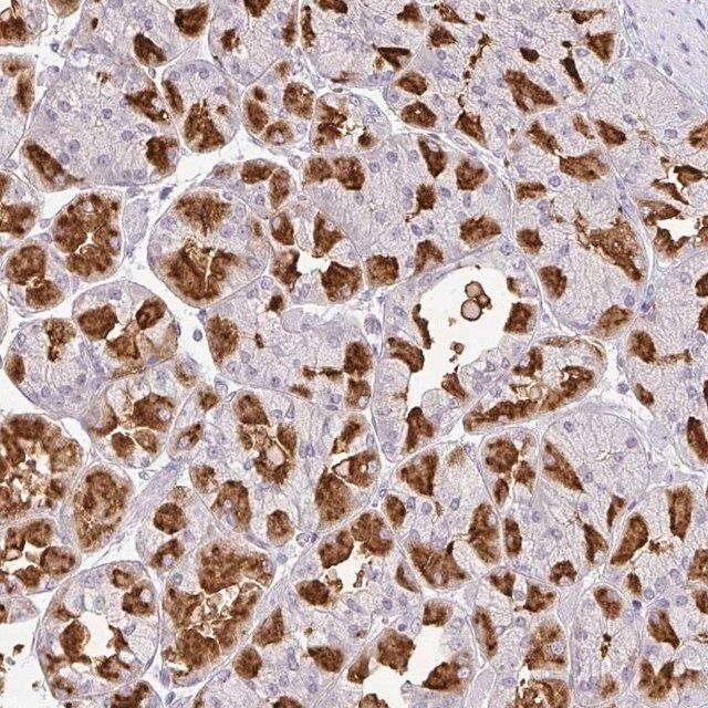 Anti-CMPK1 antibody produced in rabbit