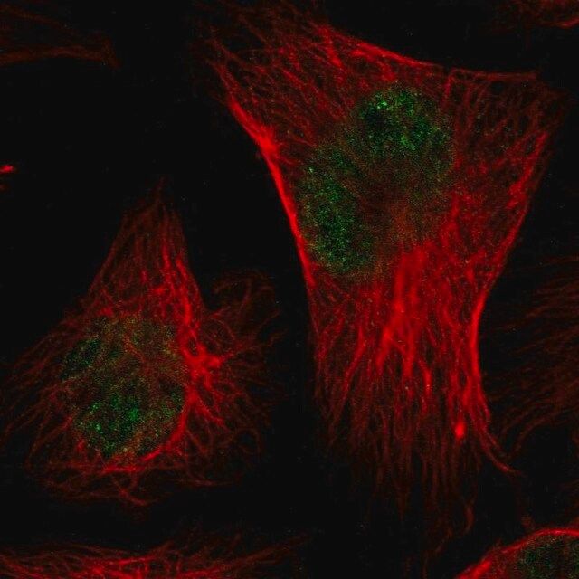 Anti-CMTM3 antibody produced in rabbit