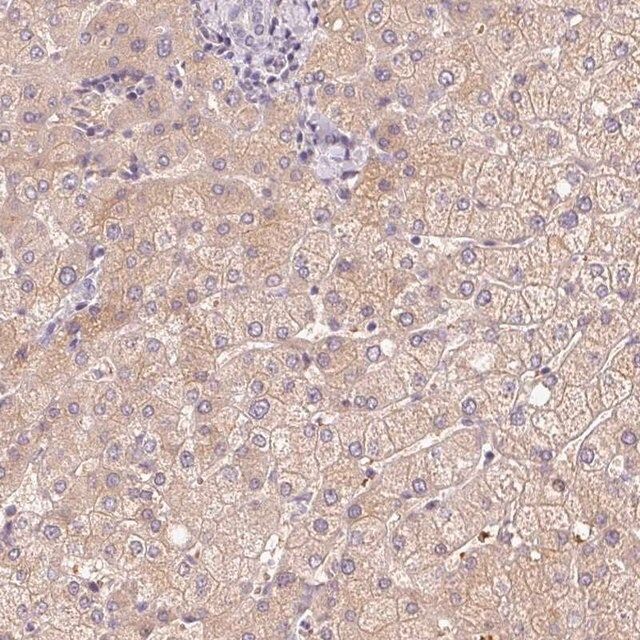 Anti-CMTM8 antibody produced in rabbit