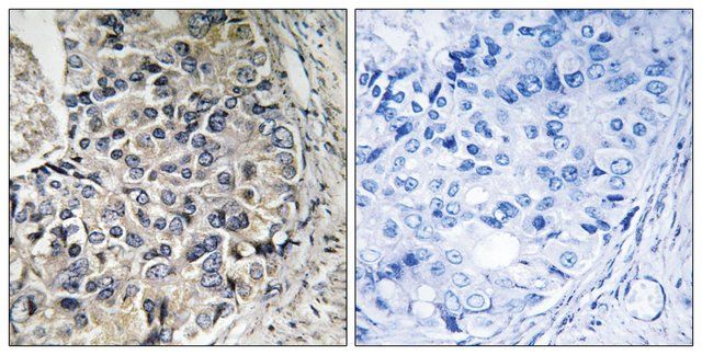 Anti-CMC1 antibody produced in rabbit