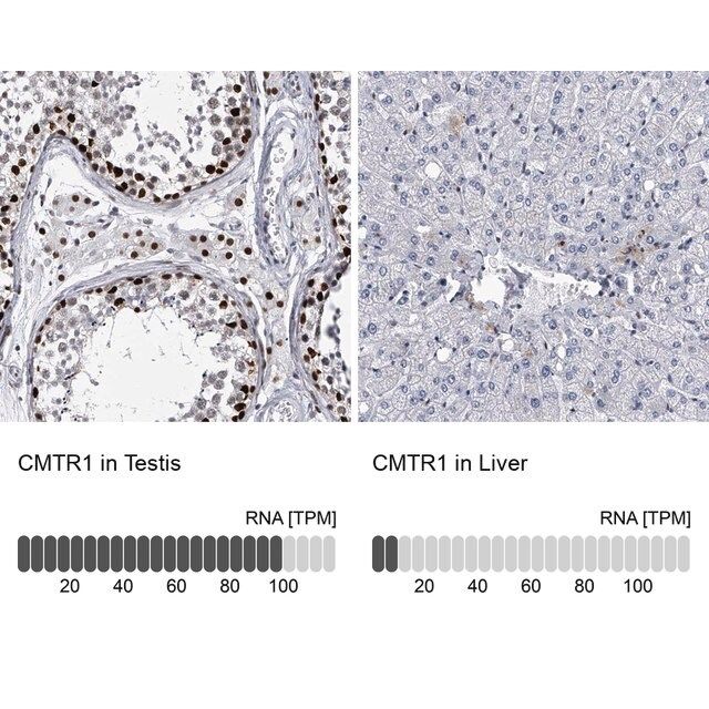 Anti-CMTR1 antibody produced in rabbit