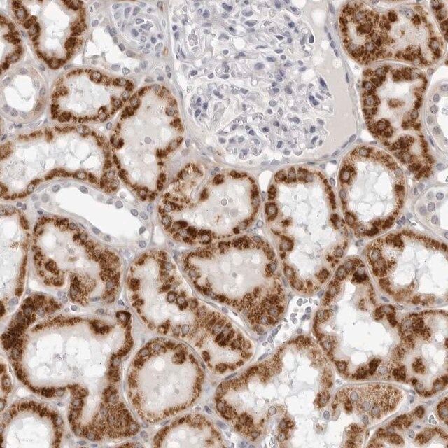 Anti-CNBD1 antibody produced in rabbit
