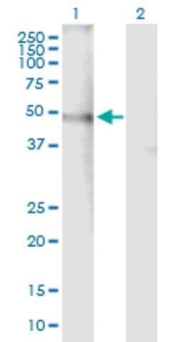 Anti-CHRNA4 antibody produced in mouse