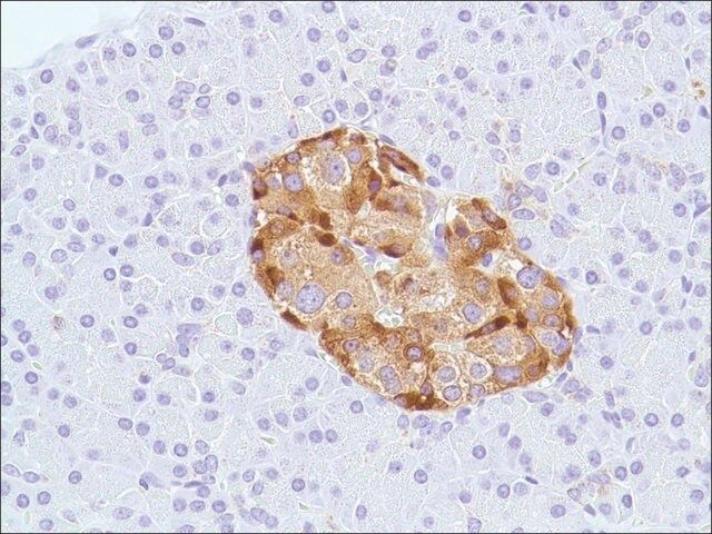 Anti-Chromogranin A antibody, Rabbit monoclonal