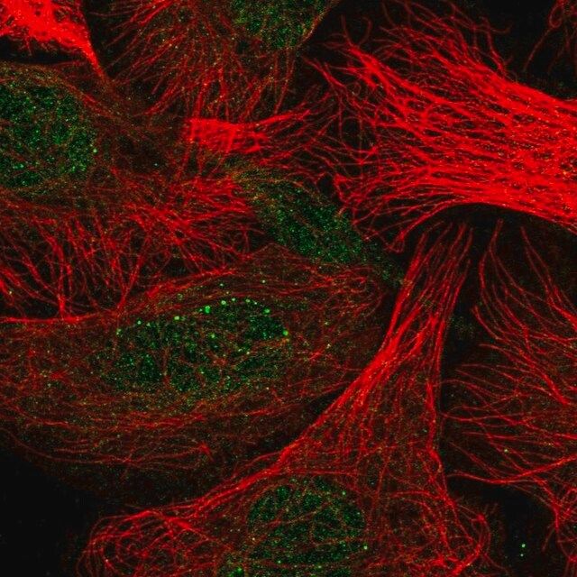 Anti-CLEC7A antibody produced in rabbit