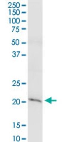 Anti-CLDN15 antibody produced in rabbit
