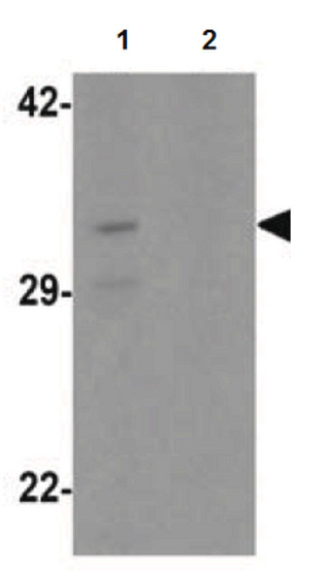 Anti-CLEC2A Antibody
