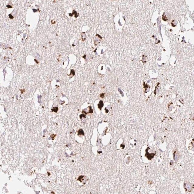 Anti-CLEC3A antibody produced in rabbit