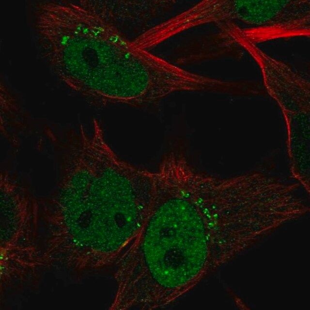 Anti-CLSPN antibody produced in rabbit
