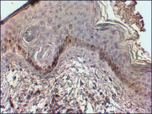 Anti-CMA1 antibody produced in goat
