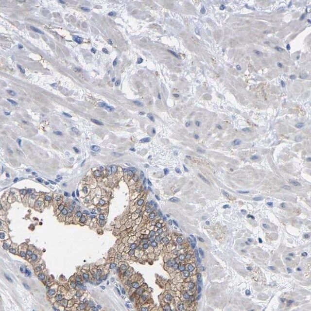Anti-CMTM1 antibody produced in rabbit