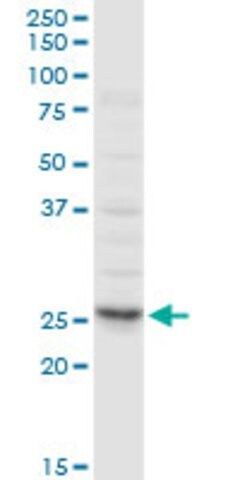 Anti-CLTA antibody produced in rabbit