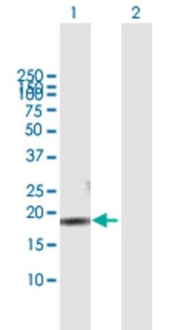 Anti-CMTM3 antibody produced in mouse
