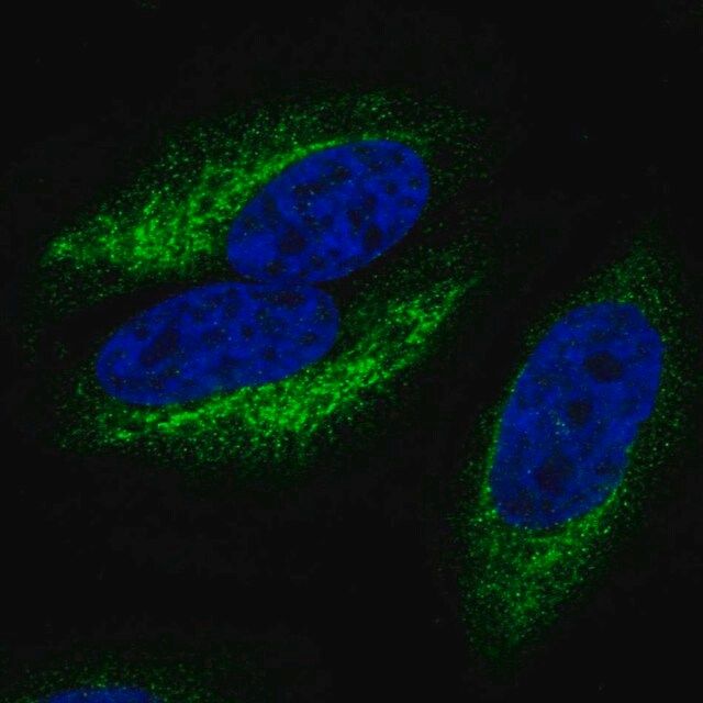 Anti-CCR10 antibody produced in rabbit