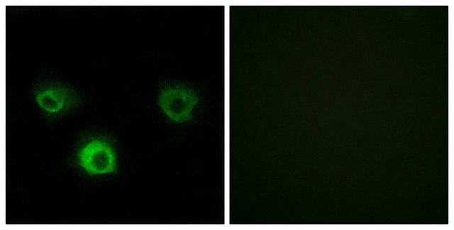 Anti-CCR4 antibody produced in rabbit