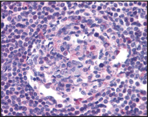 Anti-CCR5 antibody produced in rabbit