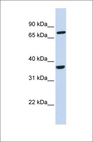 Anti-CCRL2 antibody produced in rabbit