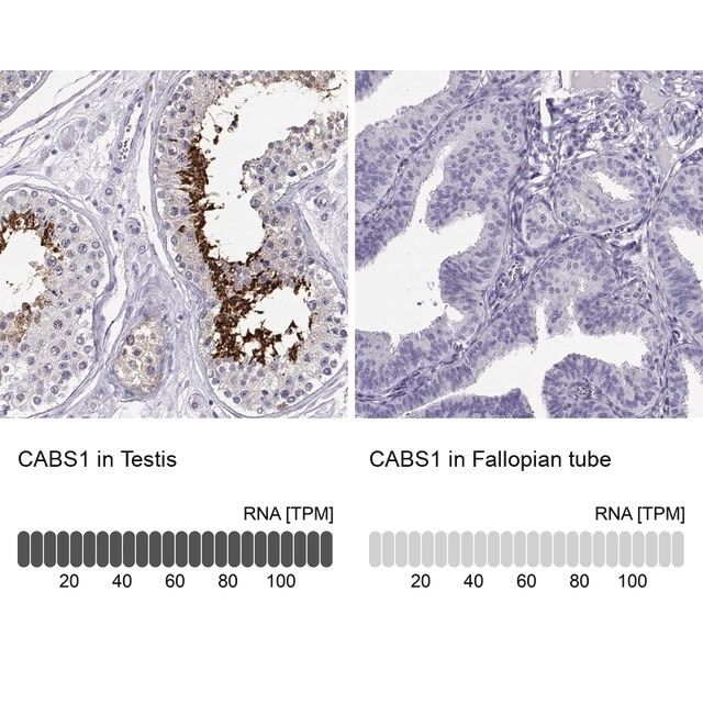 Anti-CABS1 antibody produced in rabbit