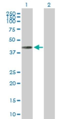Anti-CAMK1D antibody produced in rabbit