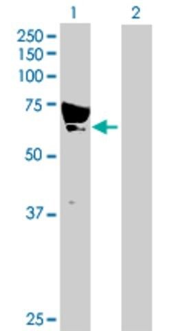 Anti-CAMKK1 antibody produced in rabbit