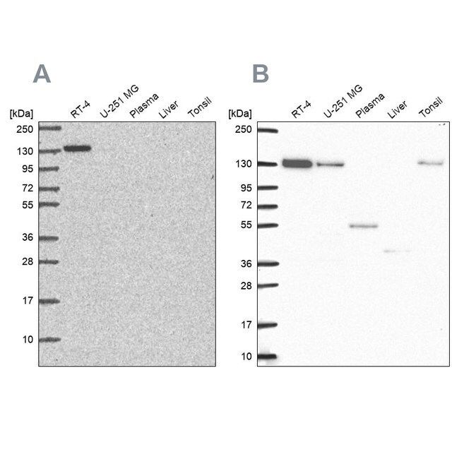 Anti-CAND1 antibody produced in rabbit