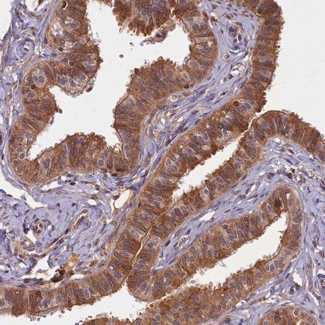 Anti-BICD1 antibody produced in rabbit