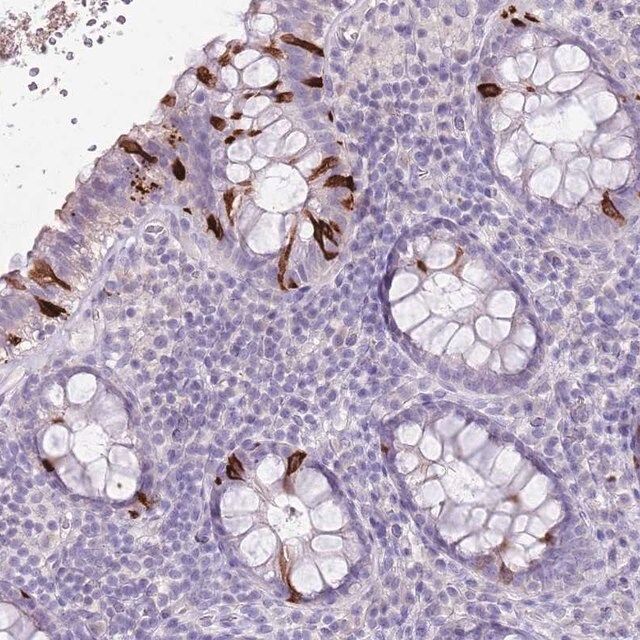 Anti-BLOC1S2 antibody produced in rabbit