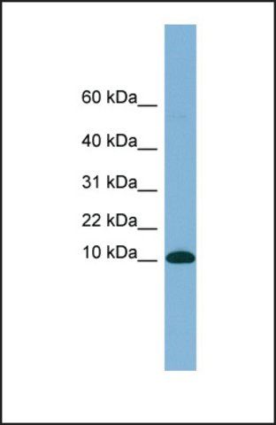 Anti-B2M, (N-terminal) antibody produced in rabbit