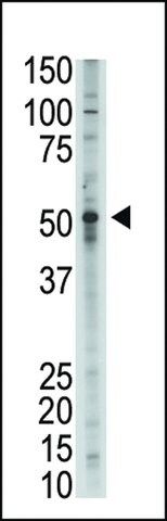 ANTI-BMP9 (GDF2)(N-TERMINAL) antibody produced in rabbit