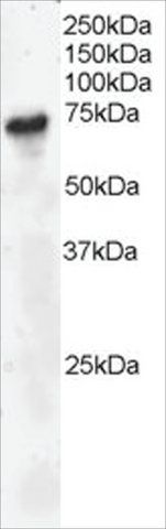 Anti-BLNK/SLP-65 antibody produced in goat