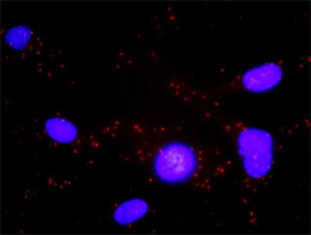 Anti-BLR1 antibody produced in rabbit