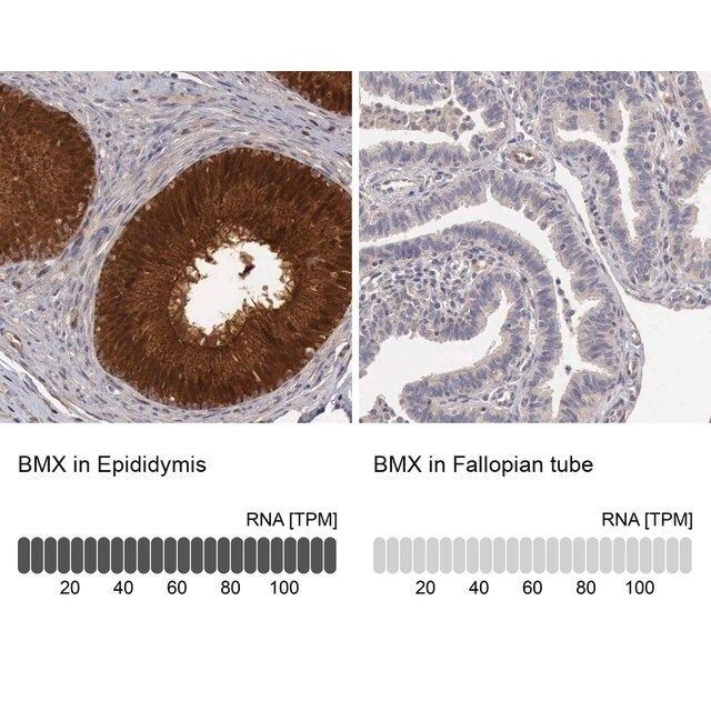Anti-BMX antibody produced in rabbit