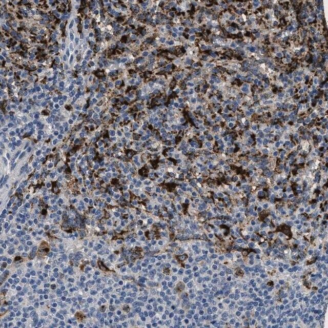 Anti-BMPR2 antibody produced in rabbit