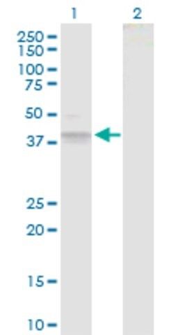 Anti-B3GAT3 antibody produced in rabbit