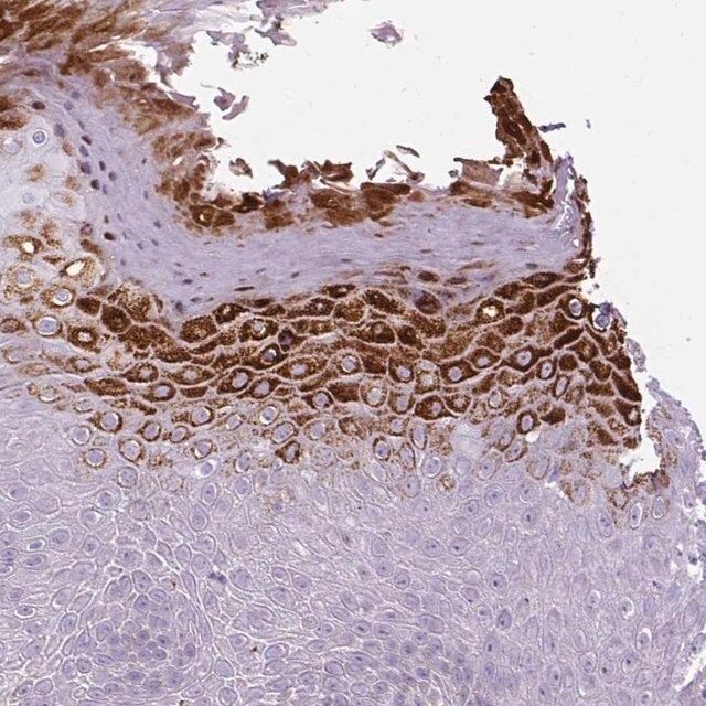 Anti-B3GNT4 antibody produced in rabbit