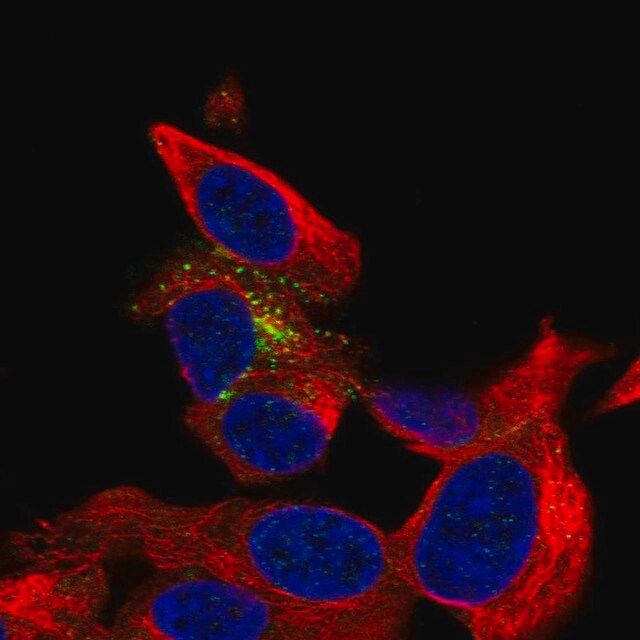 Anti-B3GAT1 antibody produced in rabbit
