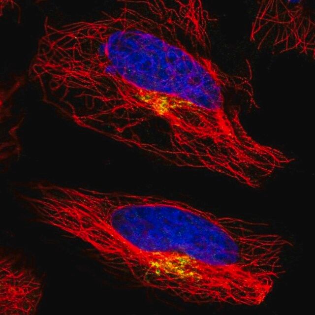 Anti-ATP7A antibody produced in rabbit