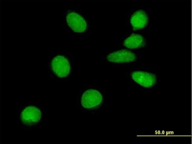 Anti-ATMIN antibody produced in mouse