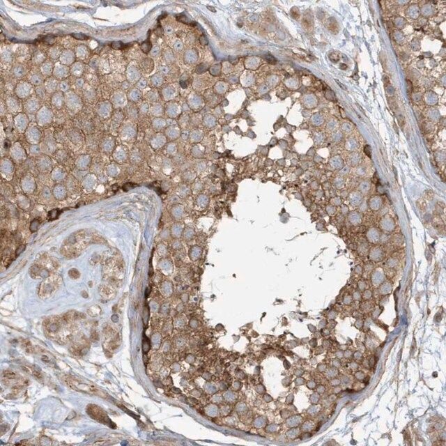 Anti-ATP23 antibody produced in rabbit