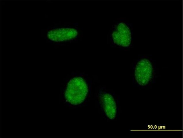 ANTI-ATOH1 antibody produced in mouse