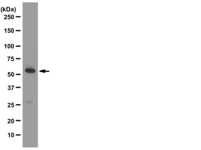 Anti-ATG5 Antibody, clone 177.19