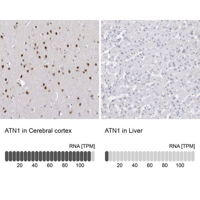 Anti-ATN1 antibody produced in rabbit