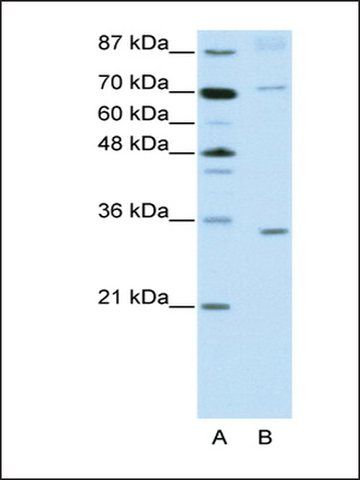 Anti-ATOH8 antibody produced in rabbit