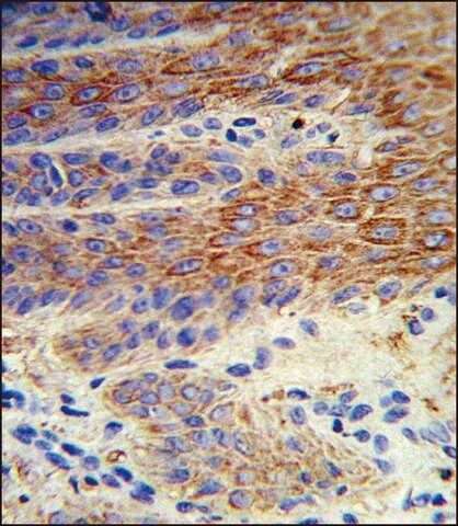 ANTI-ATP12A (CENTER) antibody produced in rabbit