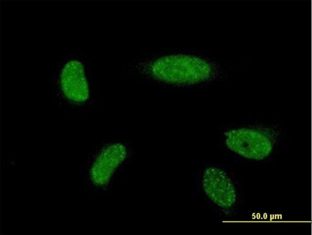 ANTI-ATOH1 antibody produced in mouse