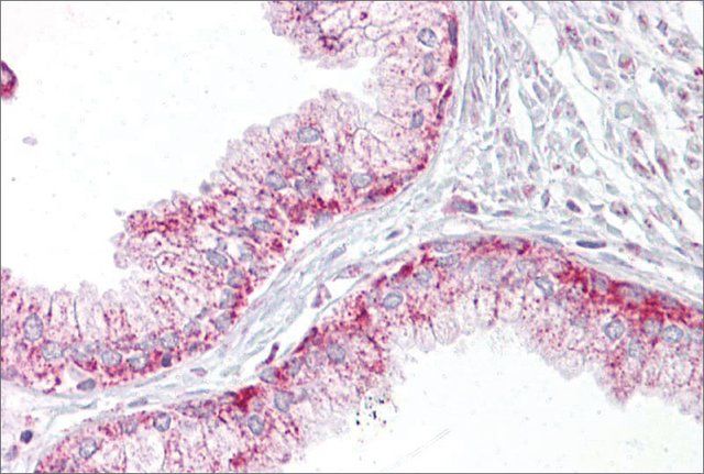 Anti-AURKA antibody produced in rabbit