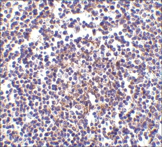 Anti-AVEN antibody produced in rabbit